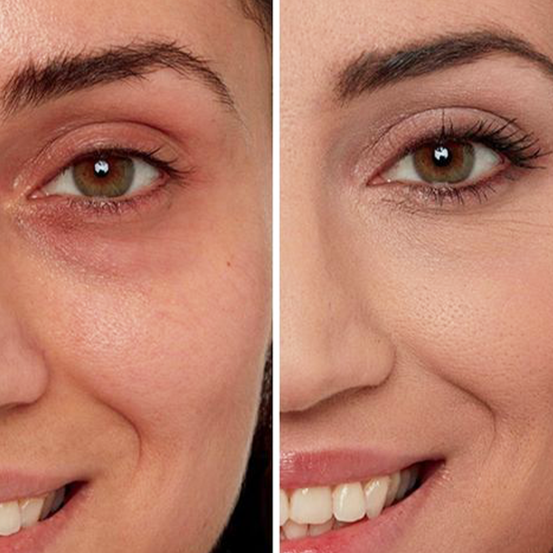 Under Eye Cream - Neolith Beauty Uk