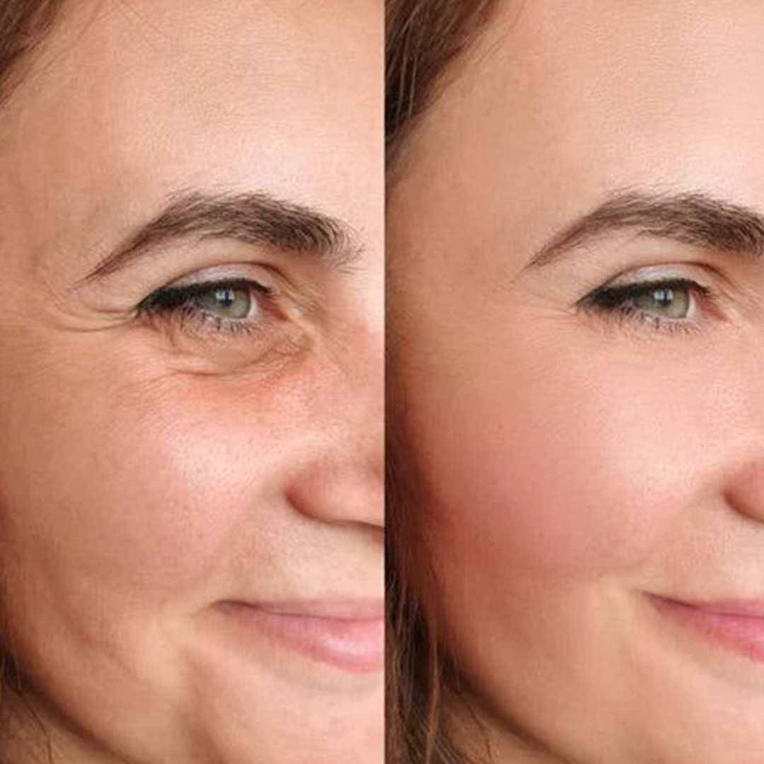 Argan Oil Anti Aging Cream - 30gm - Neolith Beauty Uk