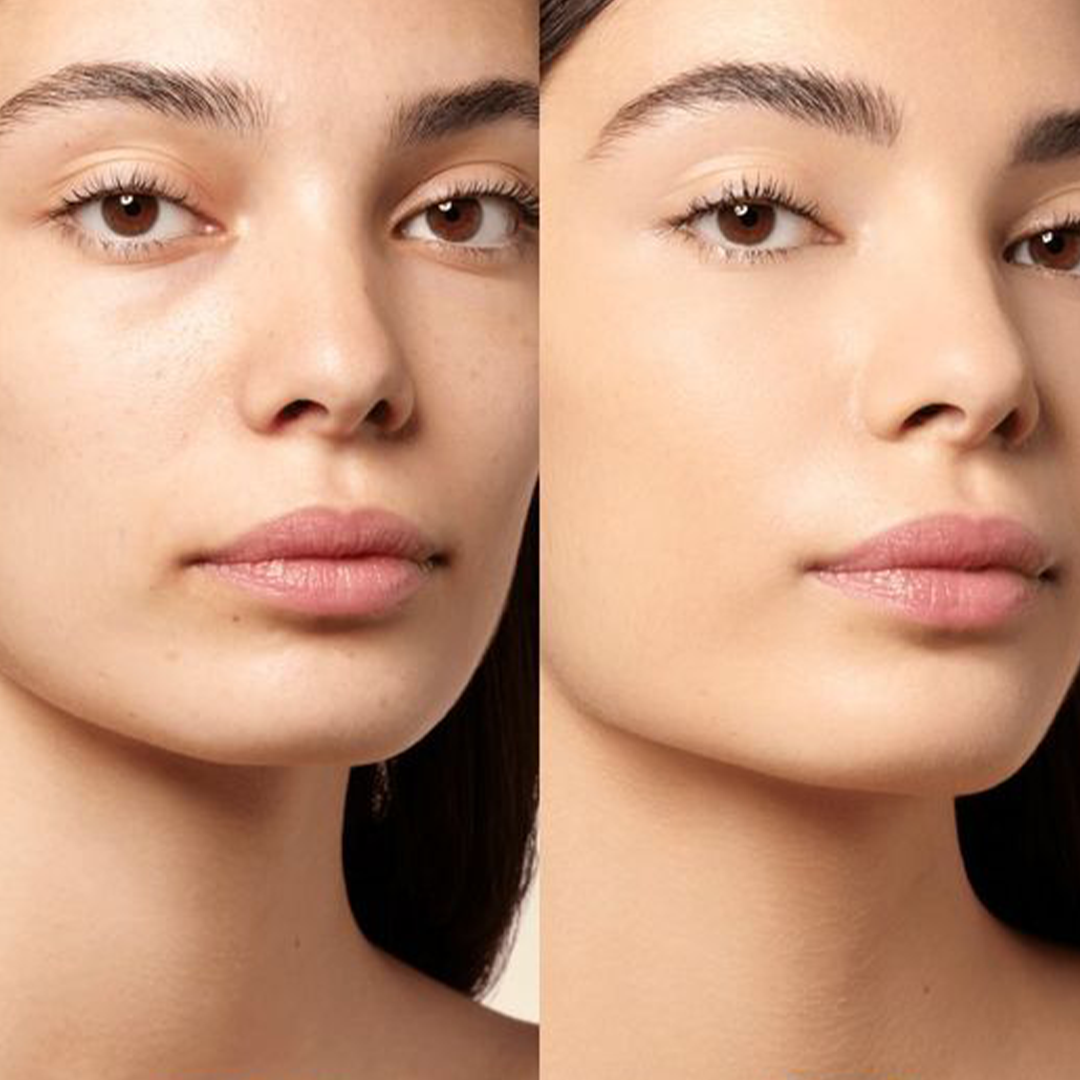 Skin Lightening Serum - 30ml Neolithbeauty