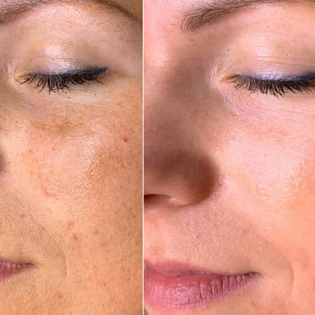 Pigmentation & Brightening Serum - 30ml Neolithbeauty